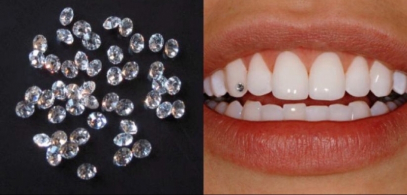 do tooth gems damage your teeth
