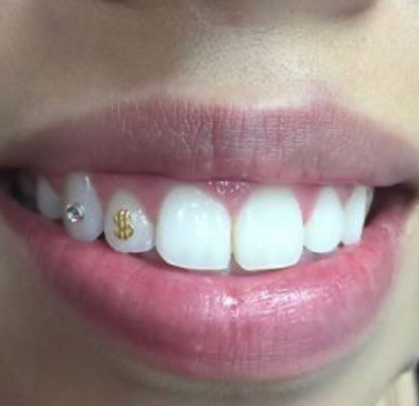 Tooth Gems Now Available! - Forever Inksanity - Tattoos & Body Piercings