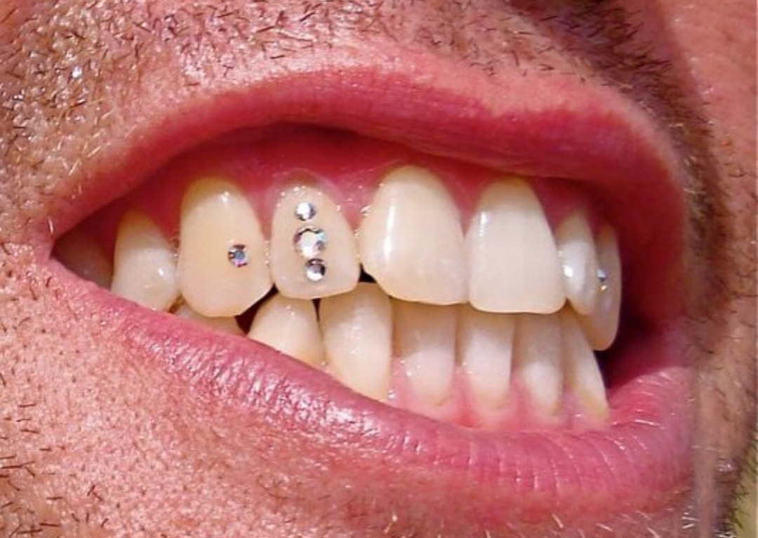 Tooth Gems Now Available! - Forever Inksanity - Tattoos & Body Piercings