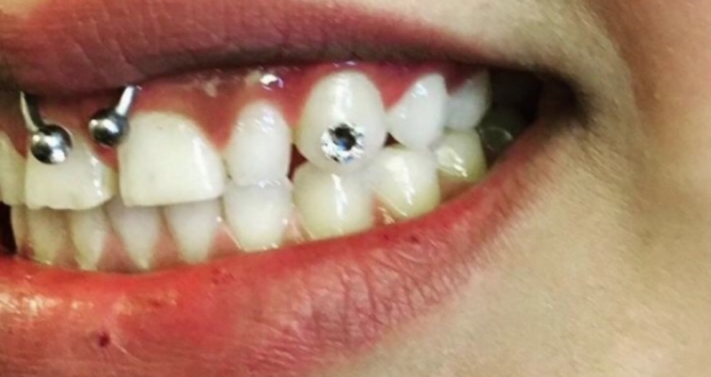 small tooth gems