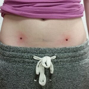 Infant Piercing in New Jersey