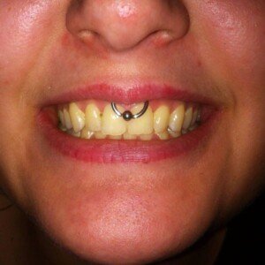 Infant Piercing in New Jersey